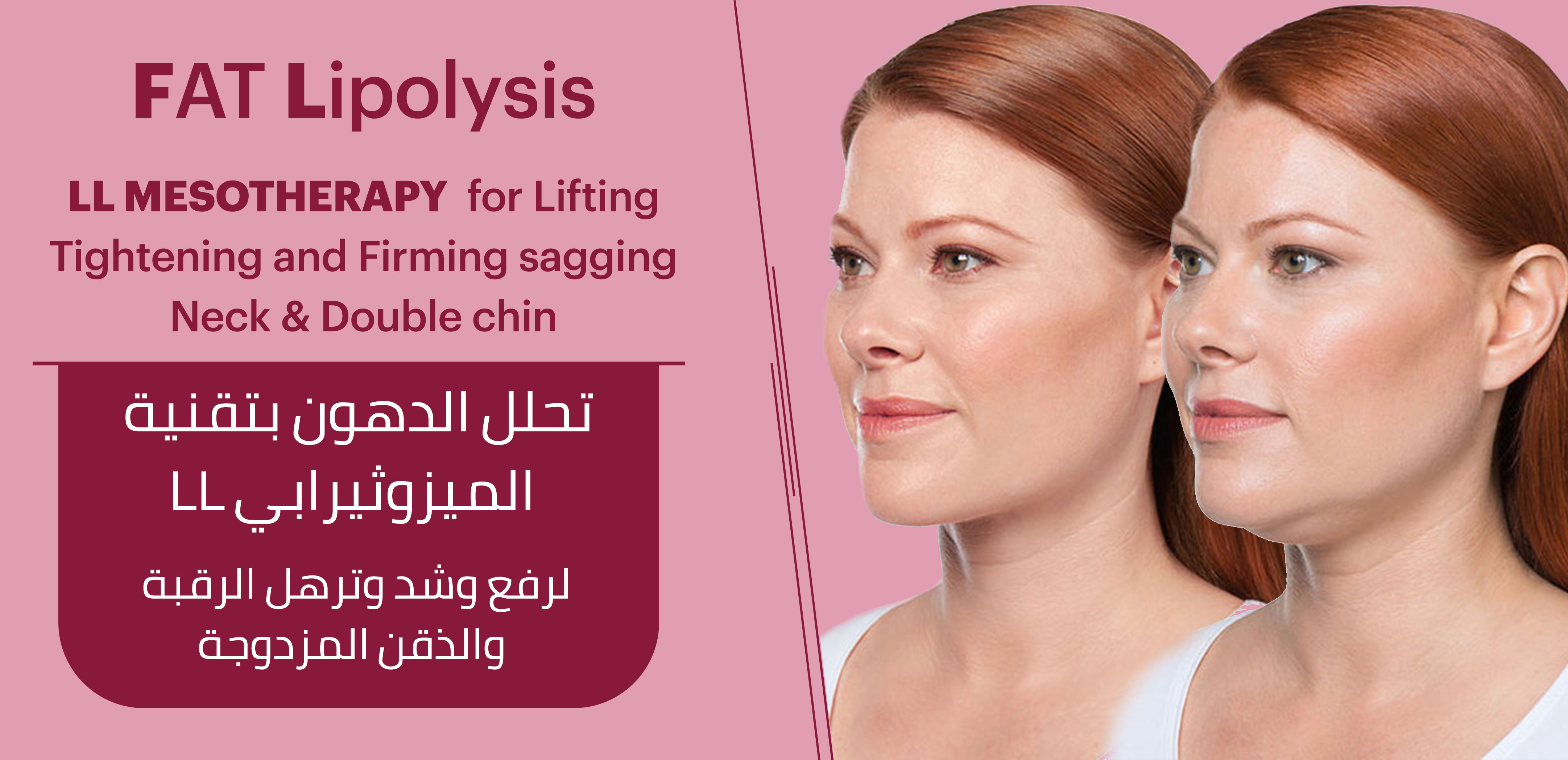 FAT LIPOLYSIS