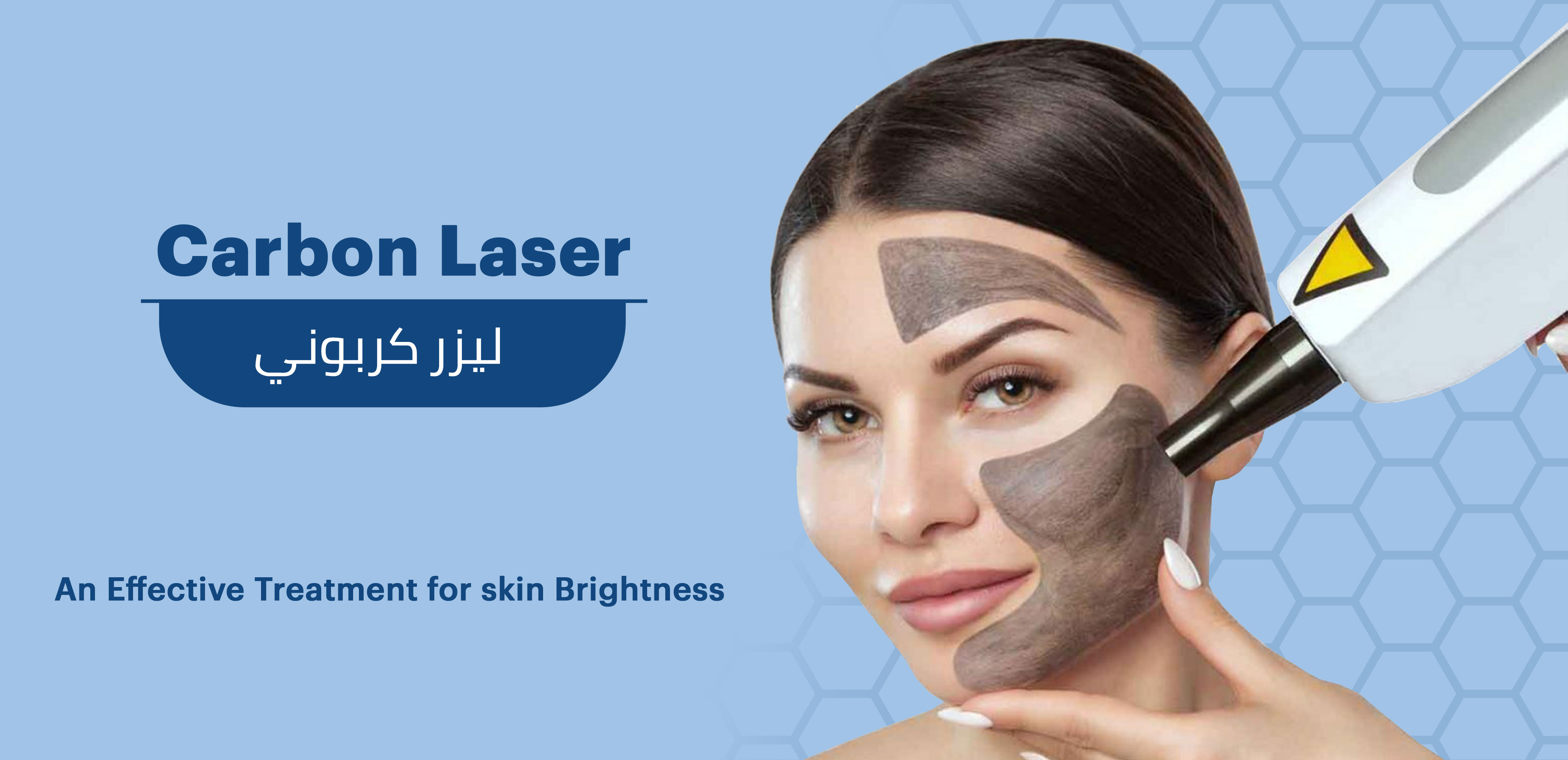 CARBON LASER PEEL