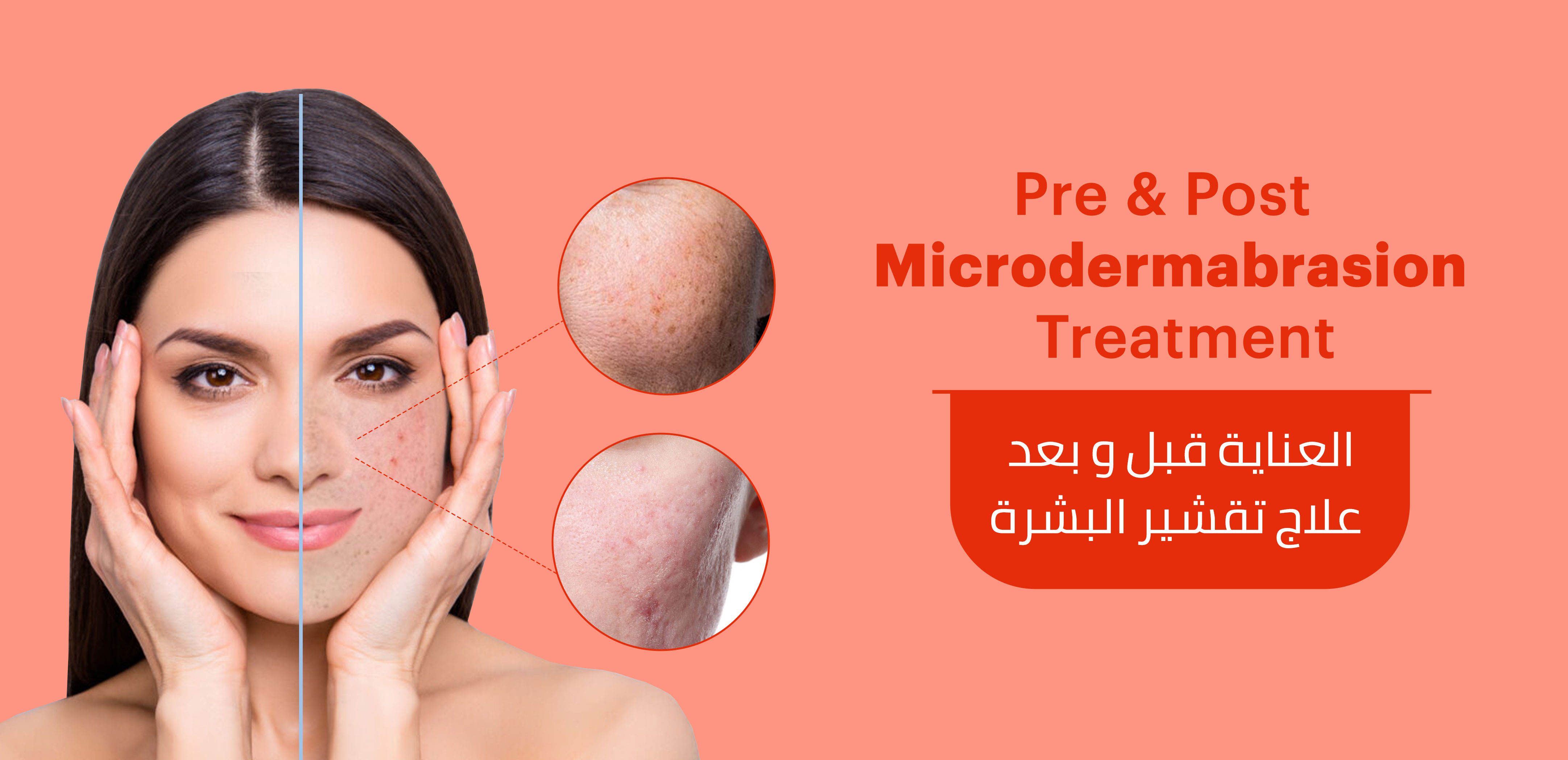 PRE & POST MICRODERMABRASION