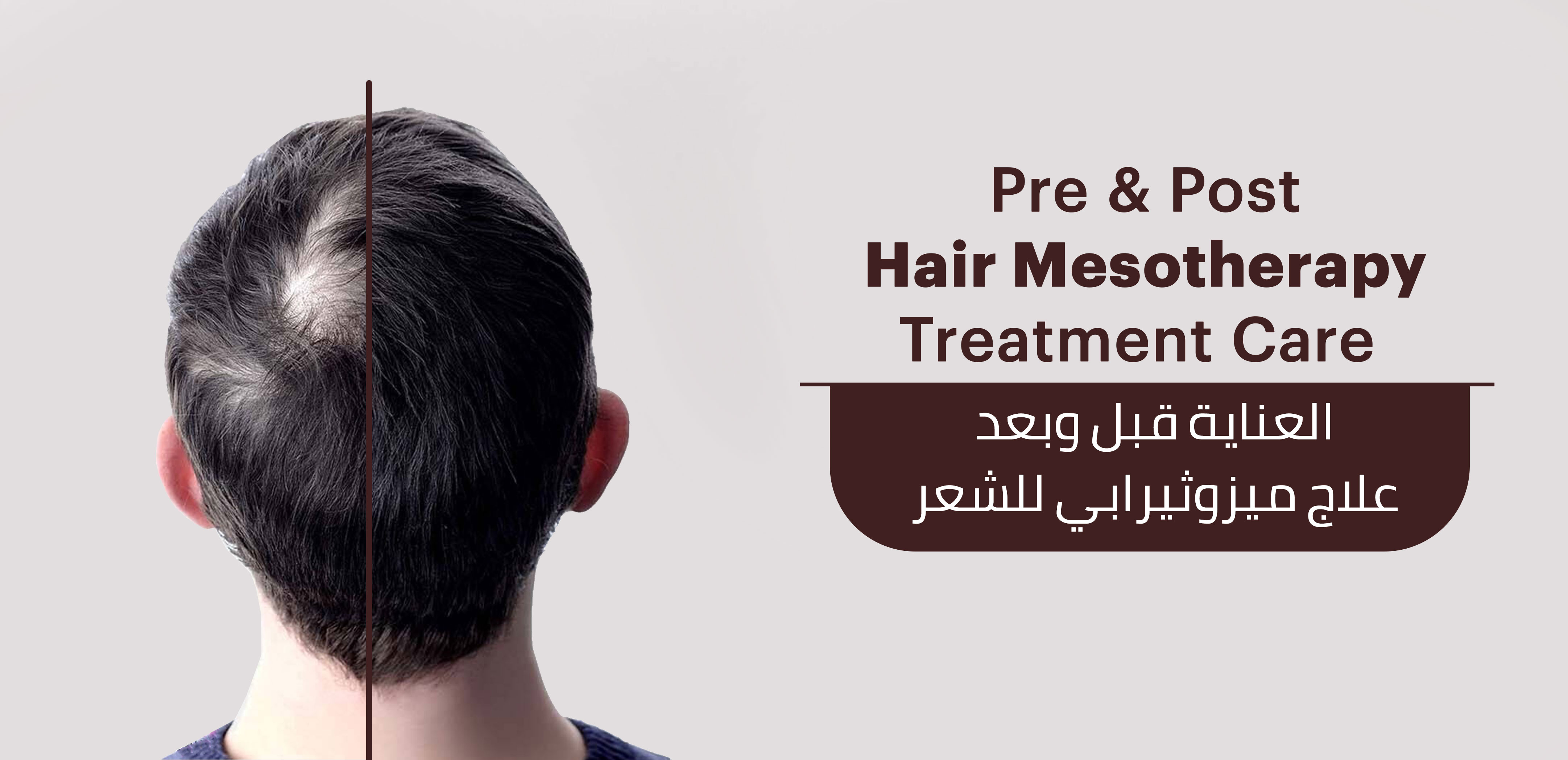 Mesotherapy