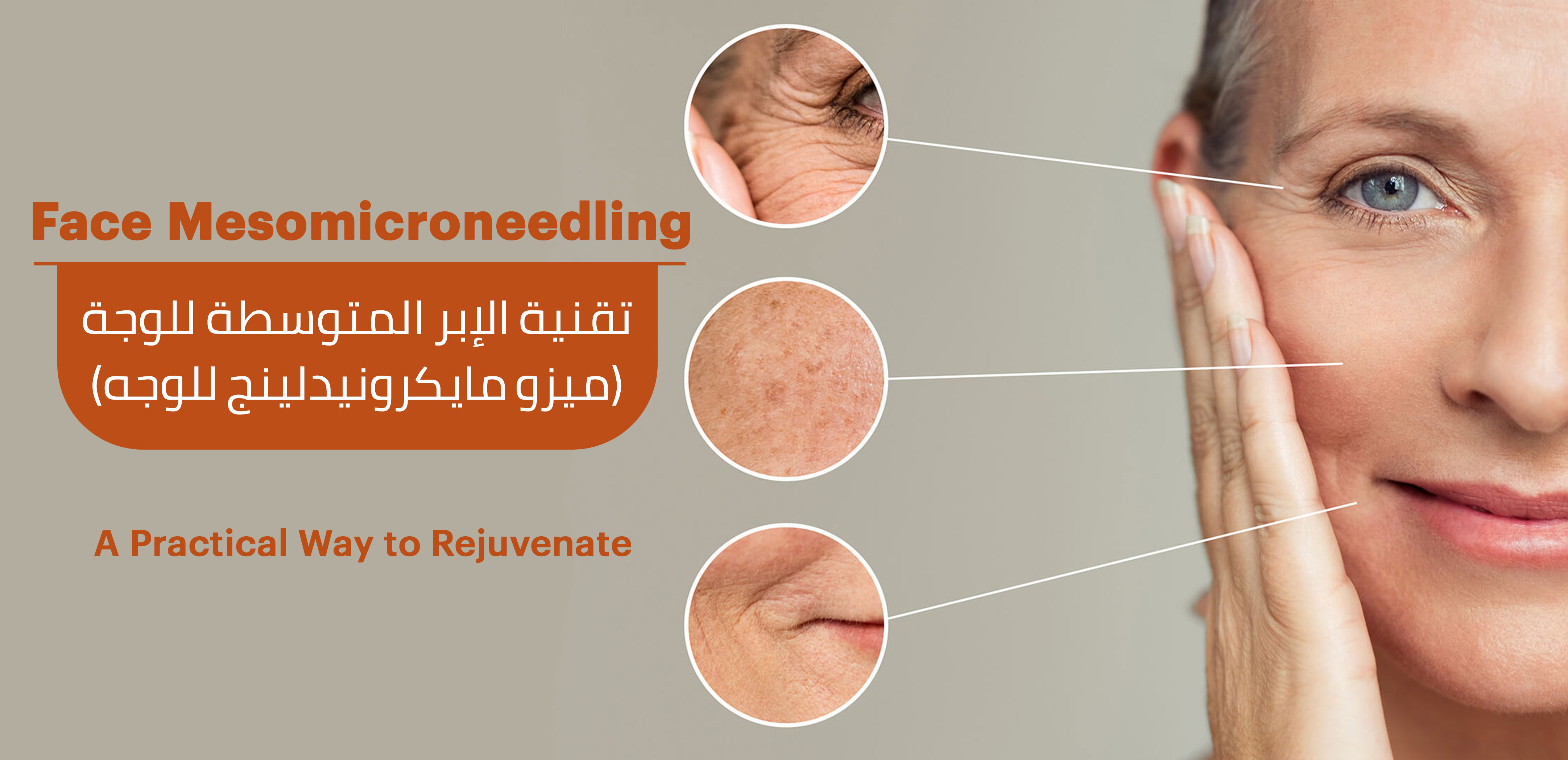 FACE MICRONEEDELING